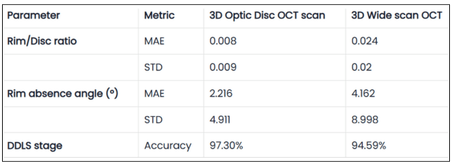 ai oct optic disc analysis