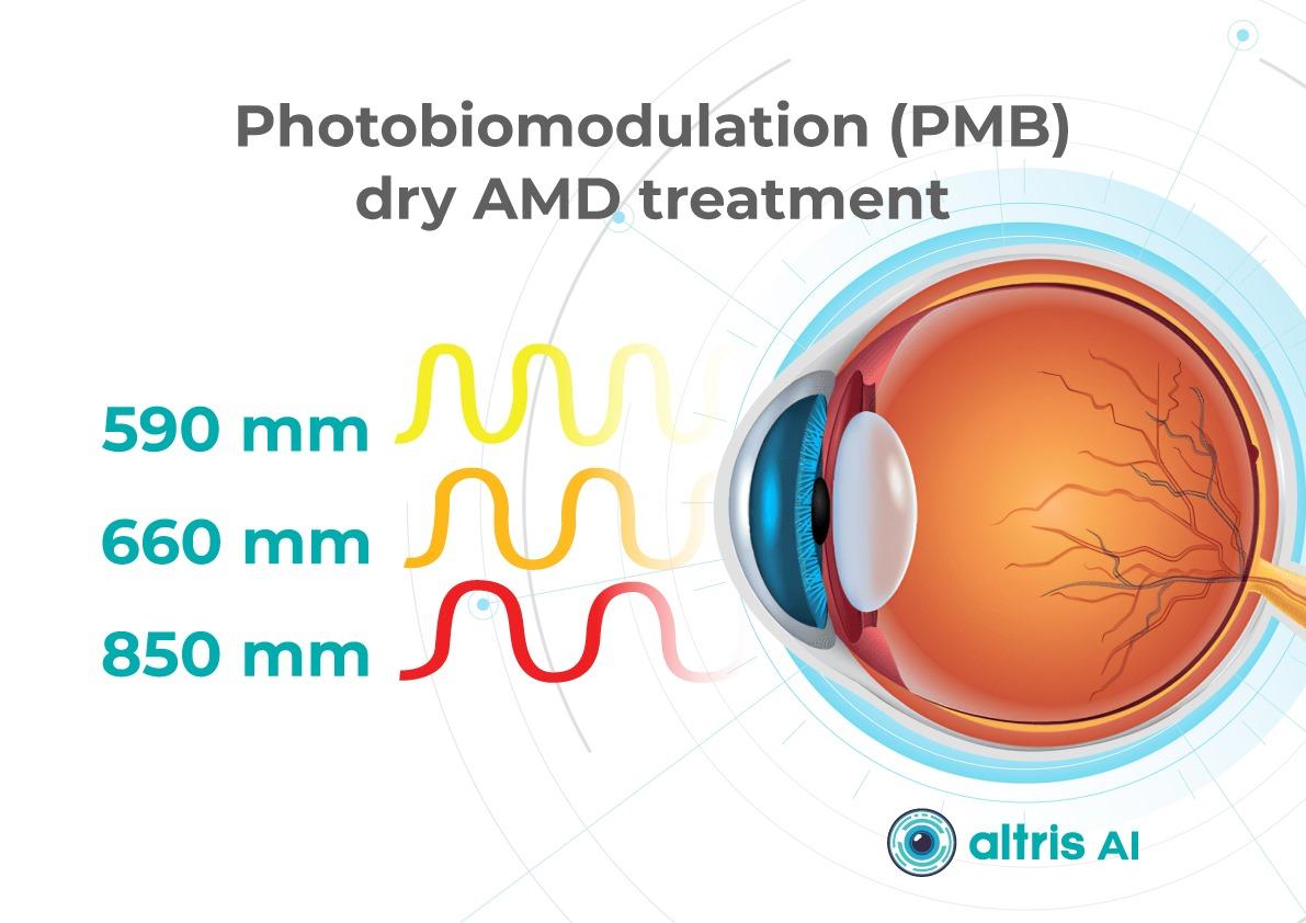Multiwavelength photobiomodulation treatment AMD Dry Macular Degeneration Treatment Breakthroughs: Multiwavelength photobiomodulation