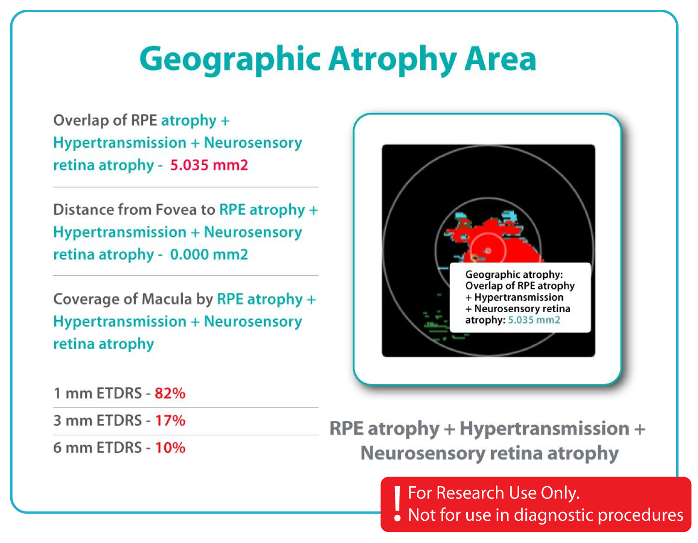 AI Ophthalmology and Optometry | Altris AI