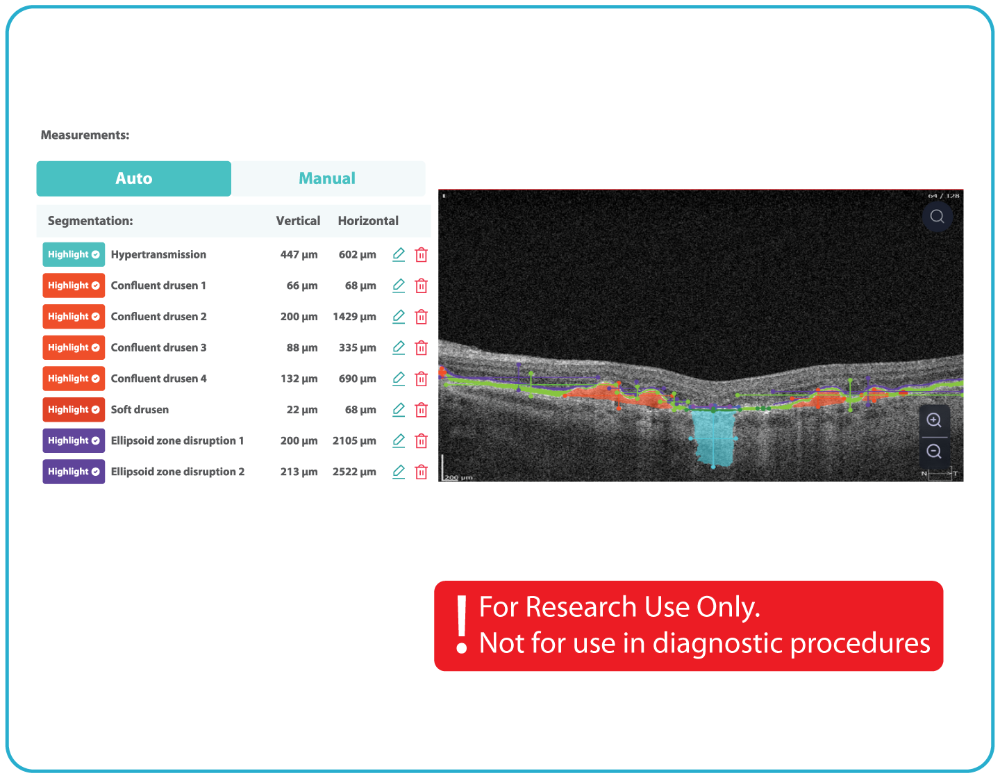 AI Ophthalmology and Optometry | Altris AI