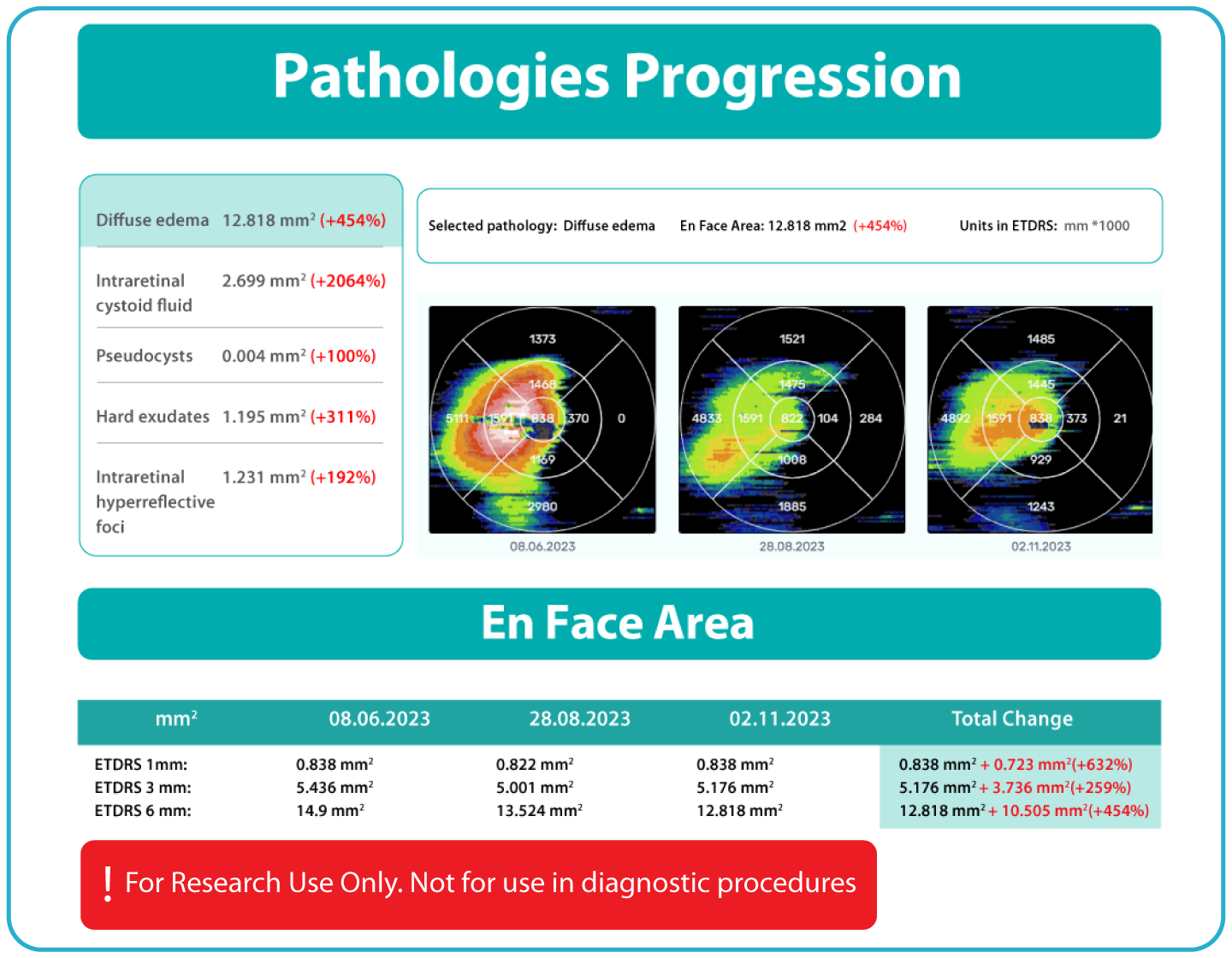 AI Ophthalmology and Optometry | Altris AI