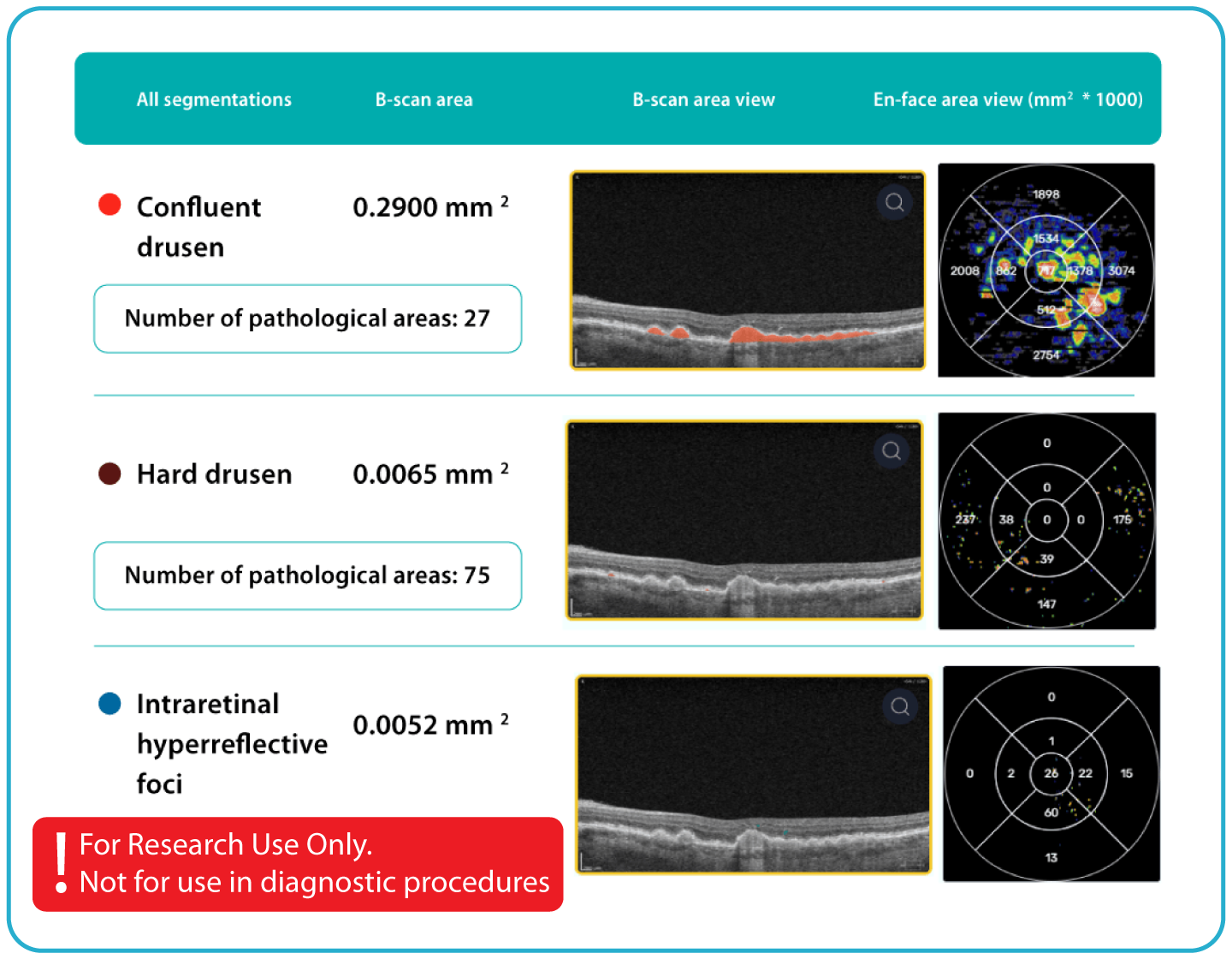 AI Ophthalmology and Optometry | Altris AI