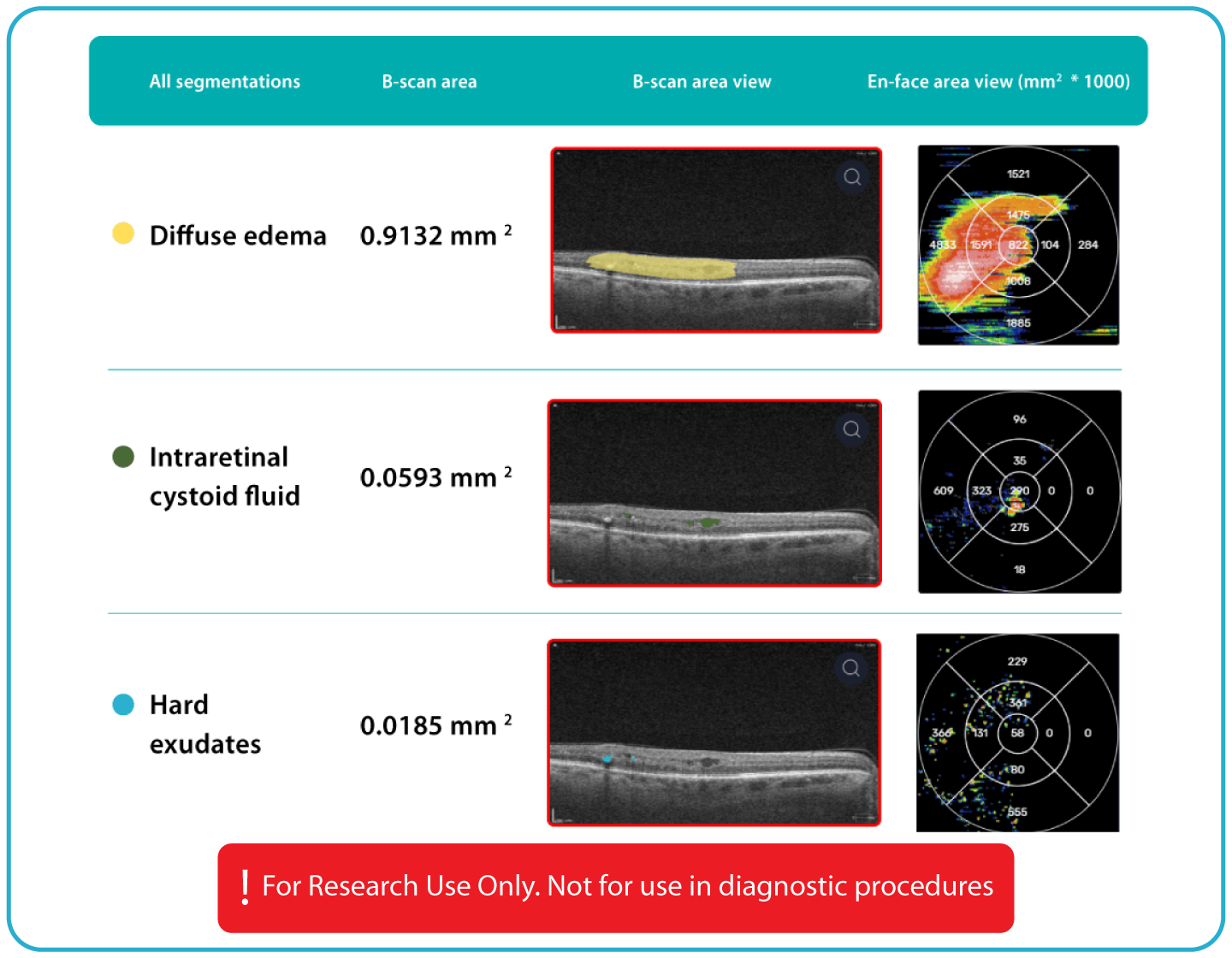 AI Ophthalmology and Optometry | Altris AI
