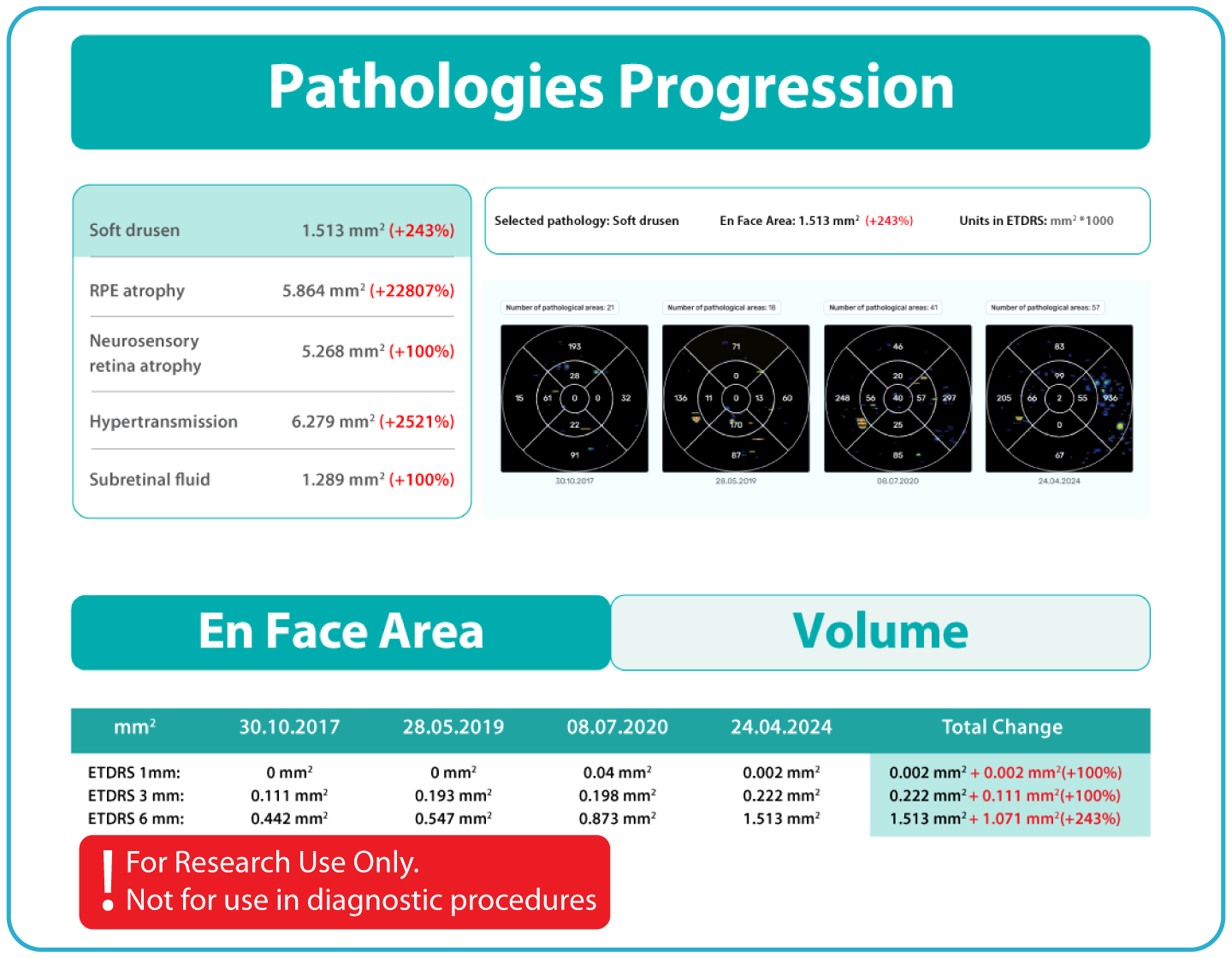 AI Ophthalmology and Optometry | Altris AI